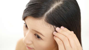 Microagulhamento do couro cabeludo